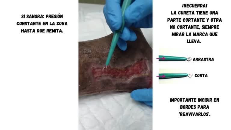 Higiene_Herida_Completa