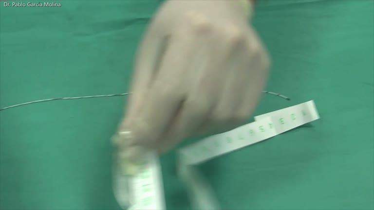 Acceso vascular central de acceso periférico
